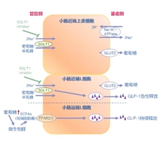 最新血糖标准一览表（2022年）